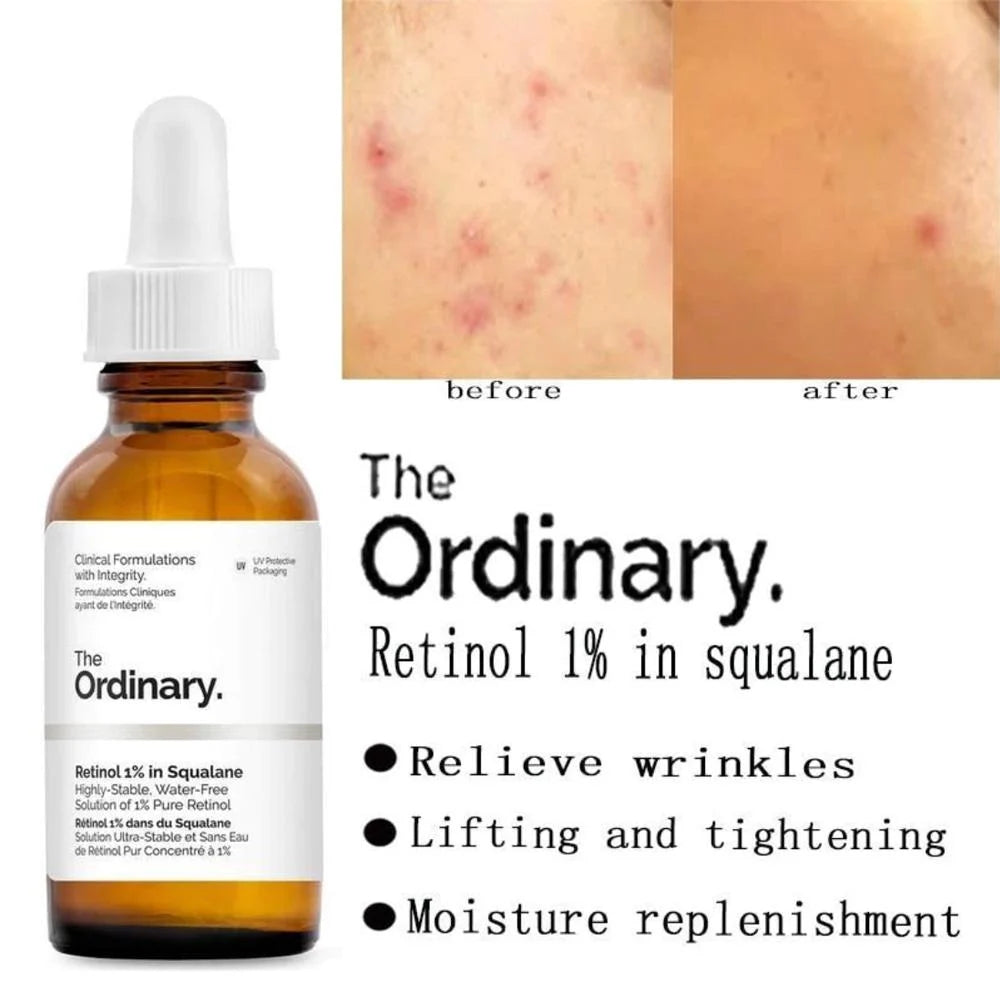 The Ordinary Retinol 1 percent in Squalane