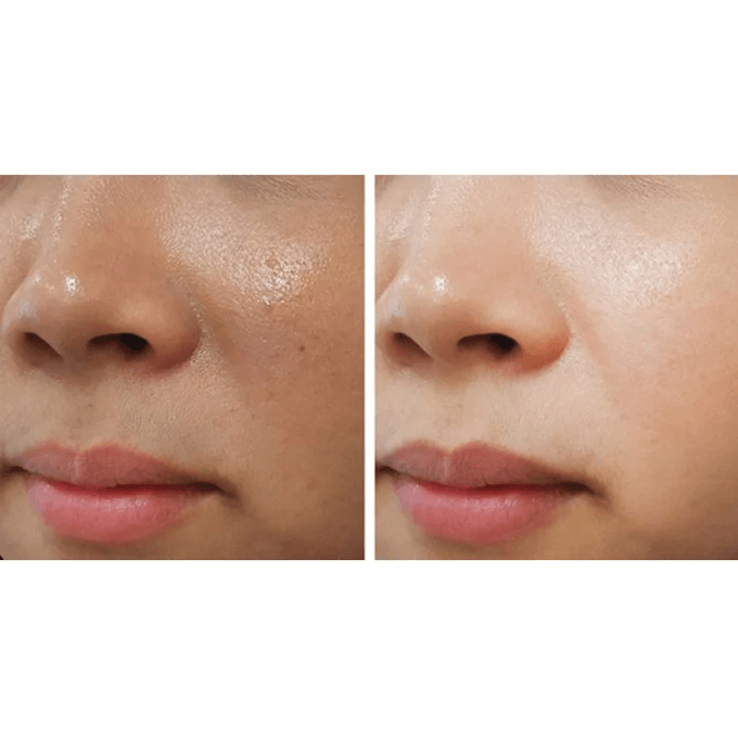 ACM Depiwhite Advanced Cream - 40ml