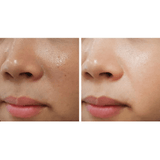 ACM Depiwhite Advanced Cream - 40ml