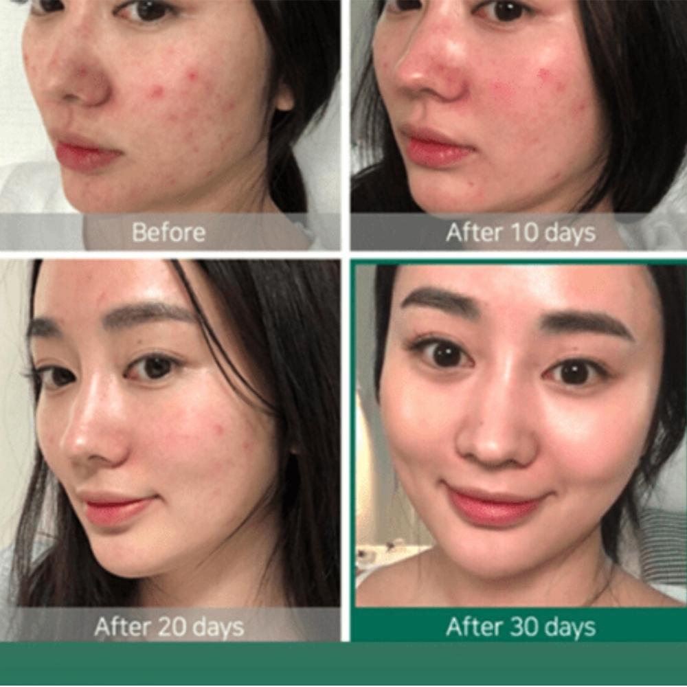 THE ORDINARY AHA 30% + BHA 2% Peeling Solution 30ml