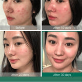 THE ORDINARY AHA 30% + BHA 2% Peeling Solution 30ml